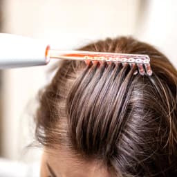 Special Herbal Hair Treatment + Ozone Therapy